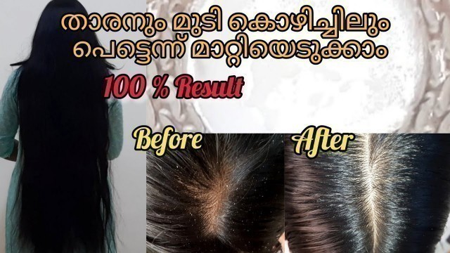 'എളുപ്പത്തിൽ താരനും മുടി കൊഴിച്ചിലും  മാറ്റിയെടുക്കാം/How To Reduce Dandruff From Hair/Food On Mind'