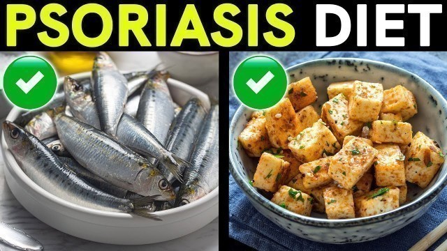 'Psoriasis Diet: Foods to Eat and Avoid If You Have Psoriasis'