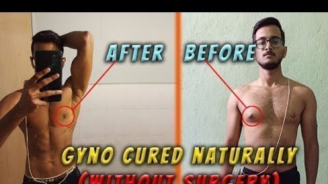 'We did an amazing Natural Gyno Transformation.'