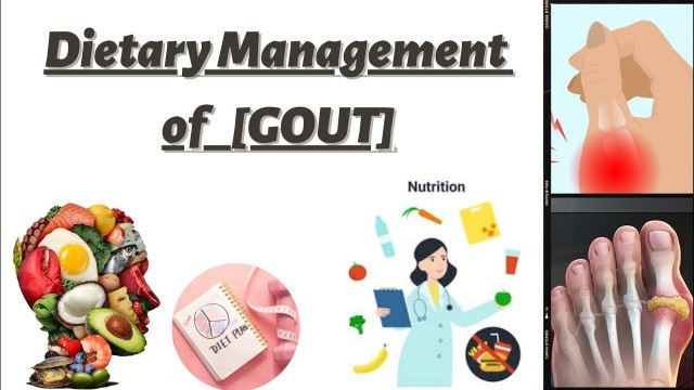 'Gout| Signs & Symptoms|Dietary Management|Food to be avoided & Included in diet'