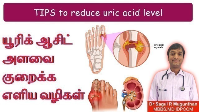 'யூரிக் ஆசிட் குறைப்பது எப்படி? யூரிக் அமிலம் குறைக்கும் உணவுகள் | Gout diet plan -TAMIL'
