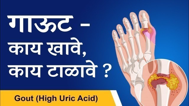 'गाऊट - काय खावे काय टाळावे ? | Gout - Foods to include and avoid  By Dr. Tejas Limaye | Martahi |'