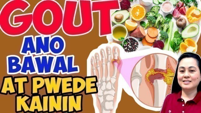 'Gout: Ano Bawal at Puwede Kainin – by Doc Liza Ong #357'