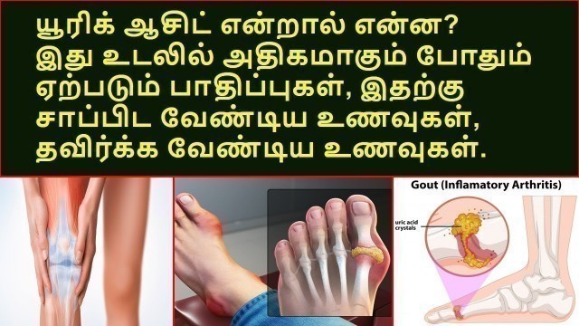 'உடலில் uric  acid அதிகம் இருந்தால் இந்த உணவுகளை தொட்டுக்கூட பார்க்காதீங்க... |  Uric acid | gout'