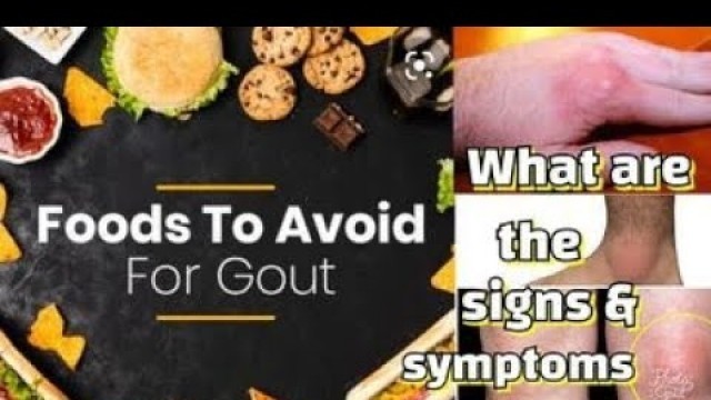 'What are the signs and symptoms of GOUT? What FOODS to AVOID?'