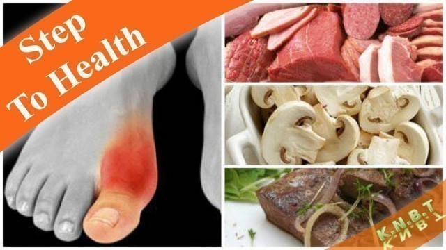 'Do You Suffer from Gout? Avoid These 7 Foods'