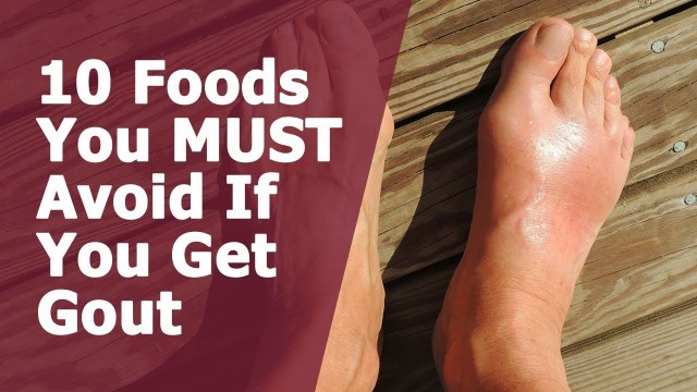 '10 Foods You MUST Avoid If You Get Gout'