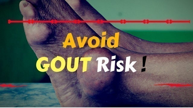 '10  Best Foods That Reduce Uric Acid - Avoid GOUT Risk !!!'