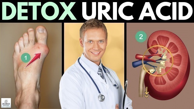 'Lowering Uric Acid Levels Quickly - Doctor Reveals 9 Best Tips (Prevent Gout Symptoms)'