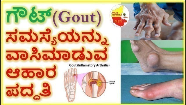 'ಗೌಟ್(Gout) ಸಮಸ್ಯೆಯನ್ನು  ವಾಸಿಮಾಡುವ ಆಹಾರ ಪದ್ಧತಿ || Best Food for Gout patients || Kannada Sanjeevani'