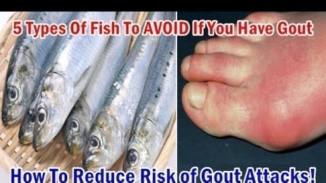 '5 Types Of Fish To AVOID If You Have Gout | Reduce Risk of Gout Attacks!'