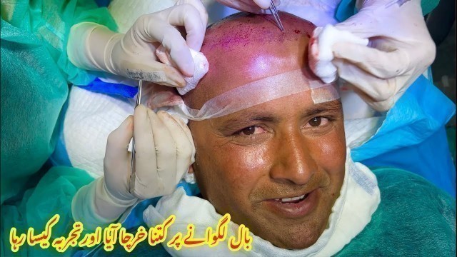 'Hair Transplant Treatment , Expense , Experience | Mubashir Saddique | Village Food Secrets'