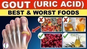 'Uric acid Foods to Avoid | Gout Diet Meal Plan | Gout | Uric acid - Best & Worst Foods'