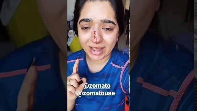 'VIRAL VIDEO:  Zomato Delivery Boy Hit a girl on her nose || Watch this video and share it everyone'